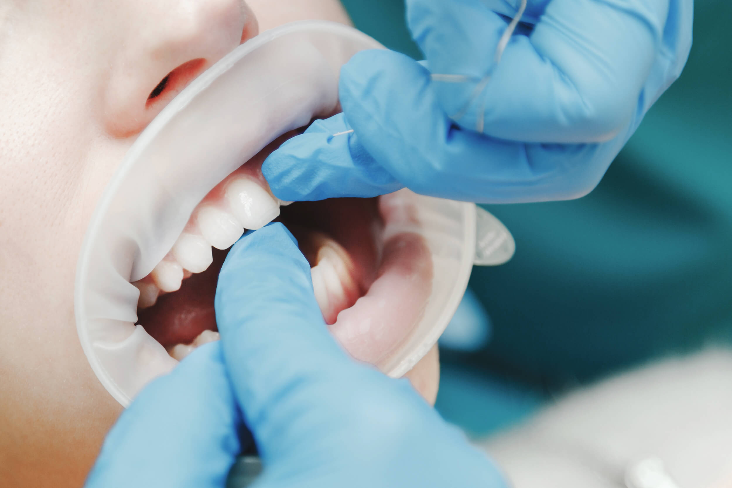 corona-dental-clinik-tj